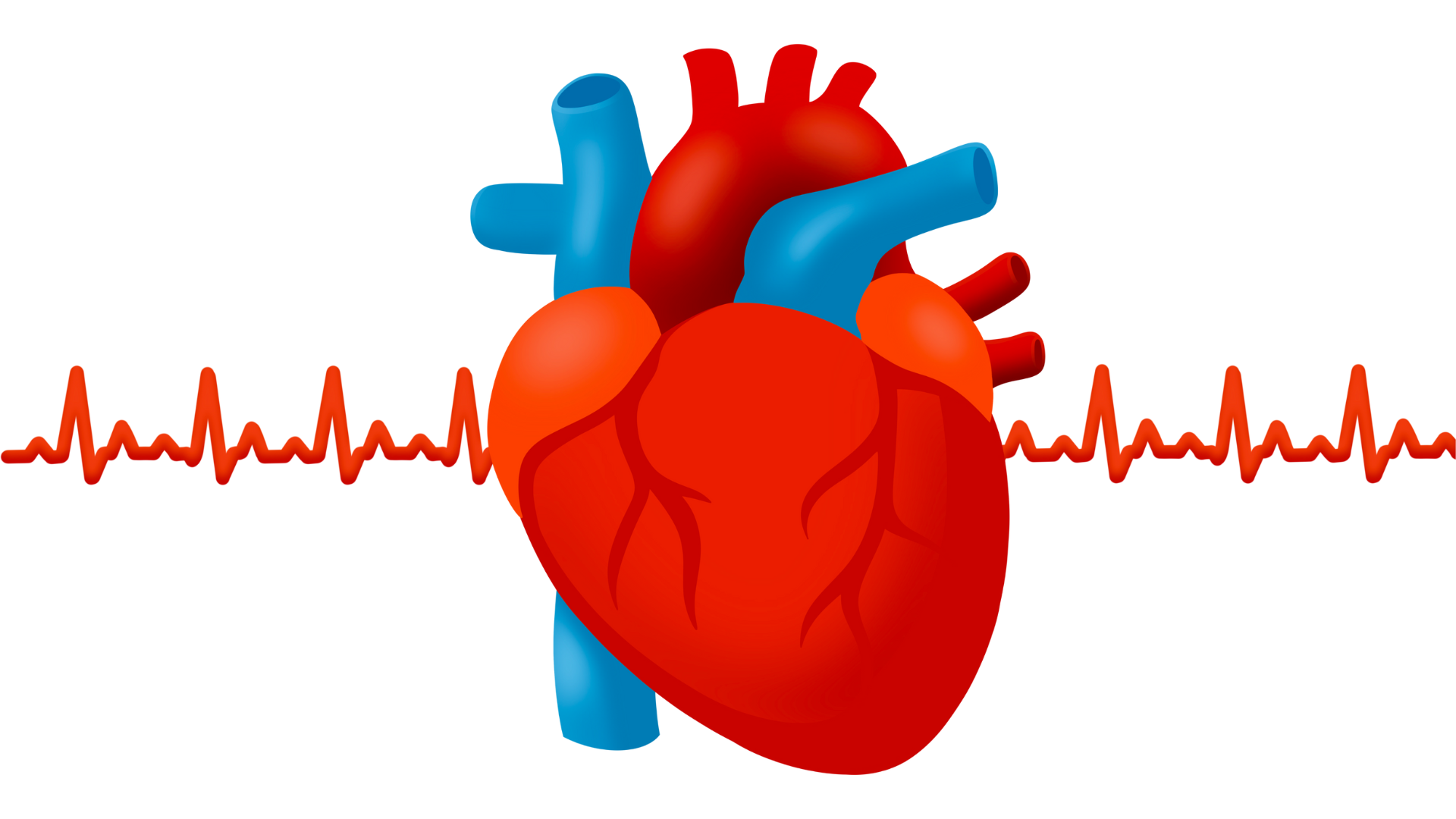 Atrial fibrillation stock image