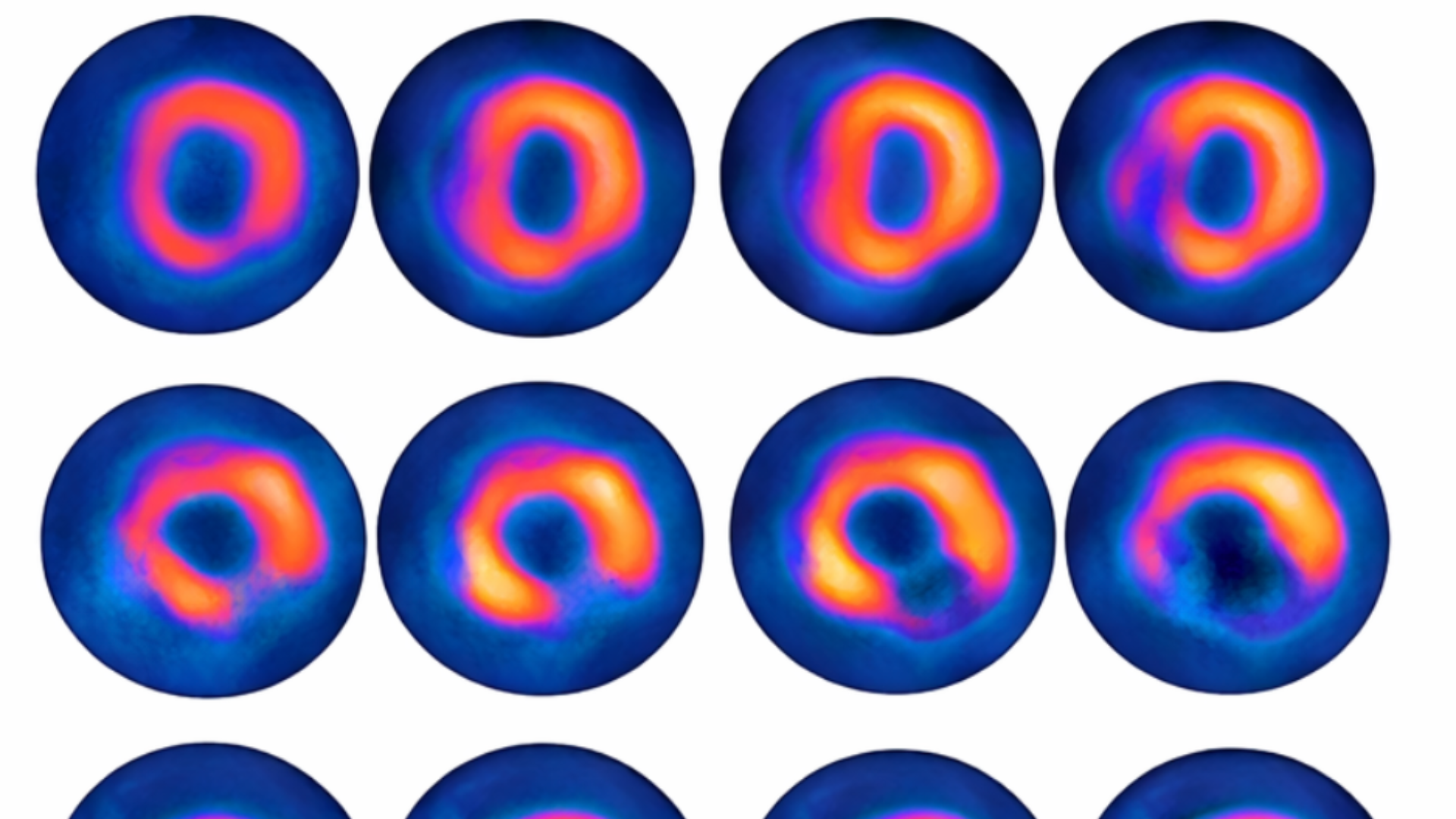 MPS scan results stock image