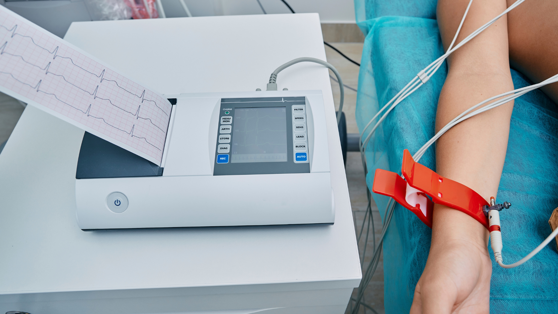 ecg test stock image