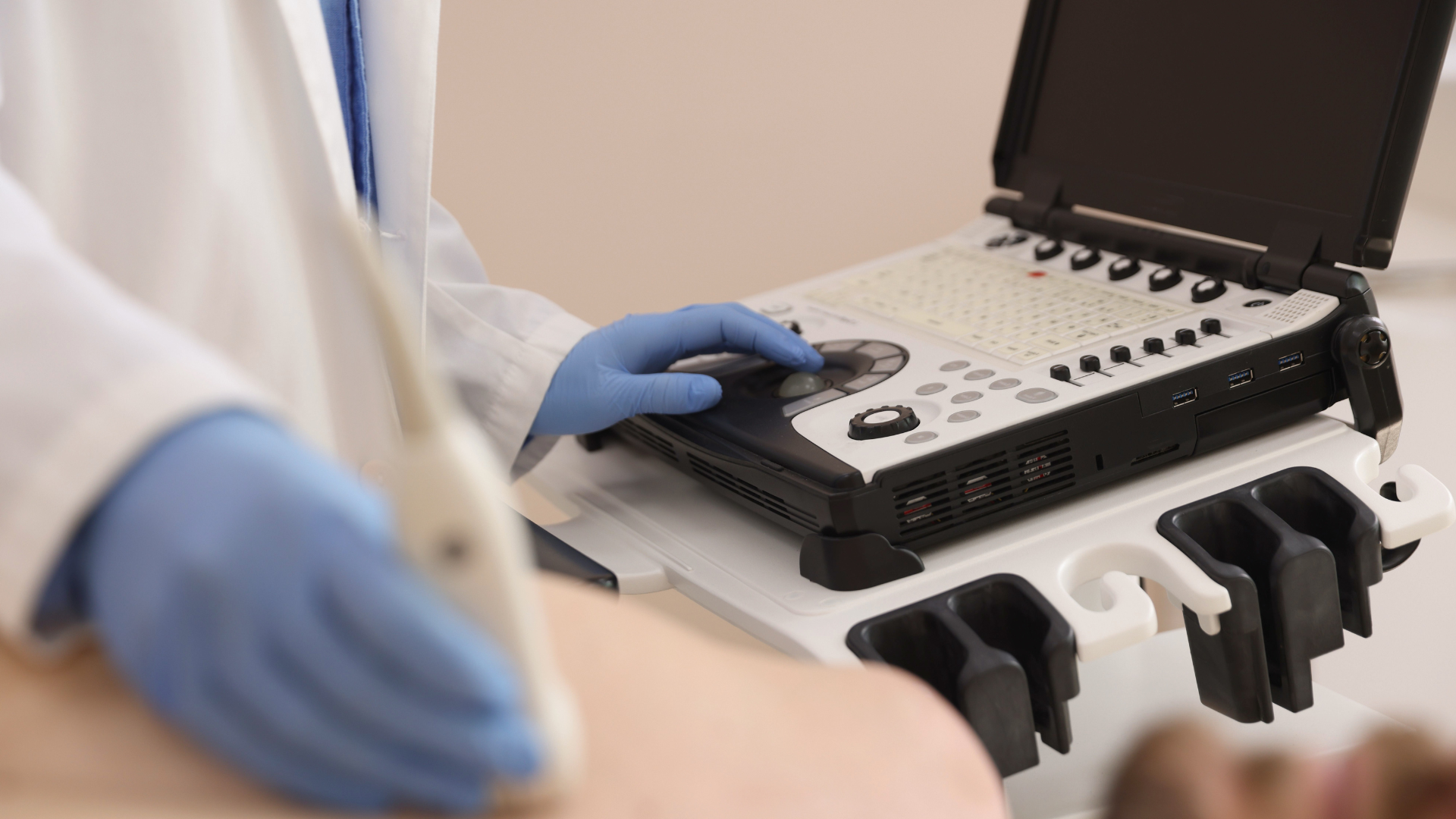 echocardiogram machine stock image